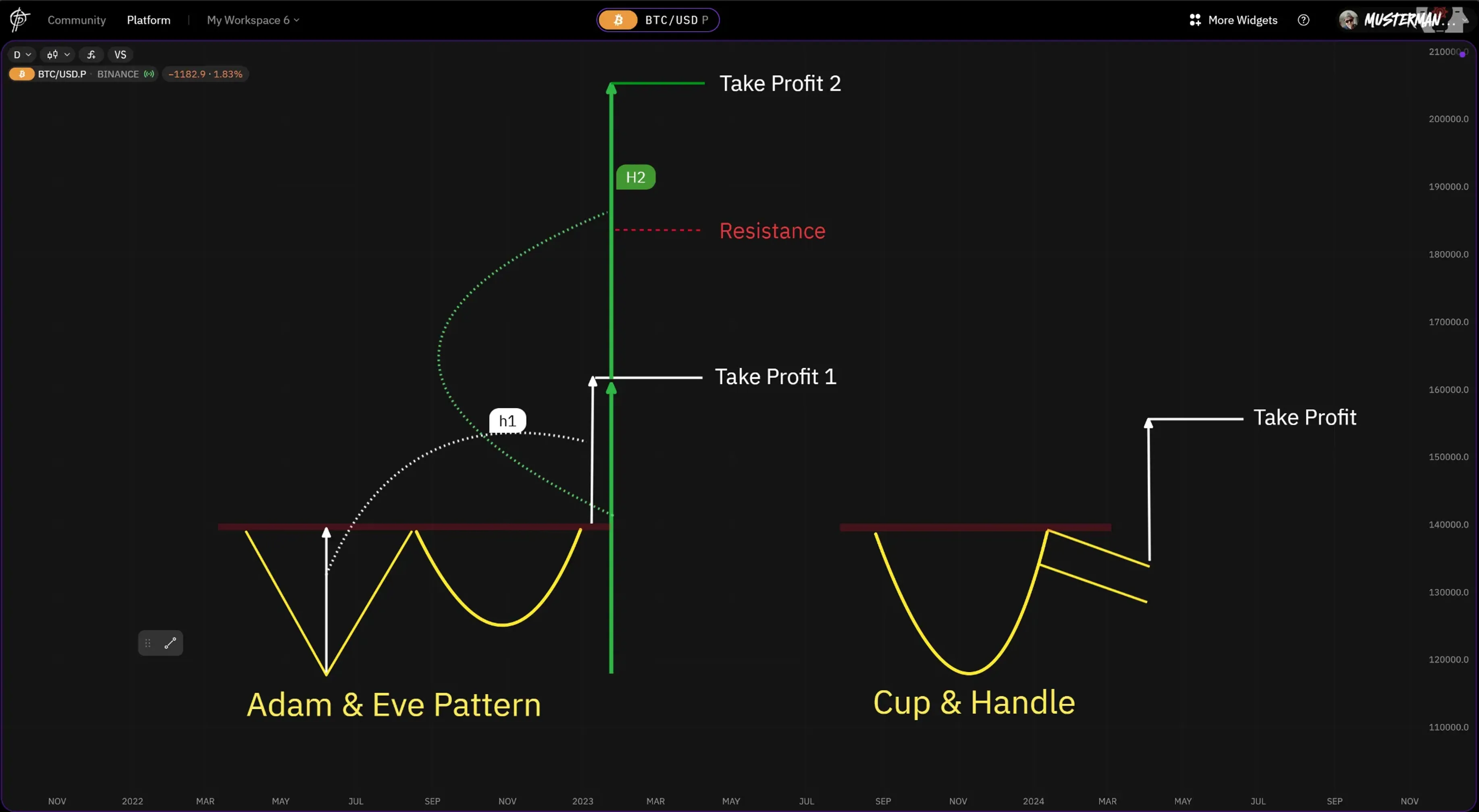 Pic shows the difference between the Adam & Eve Pattern and the Cup & Handle Pattern. 